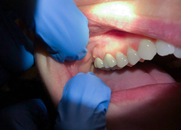 Best Emergency Dentist for Special Needs Patients in Athens, TX