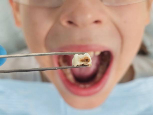 Best Mobile Emergency Dentist in Athens, TX