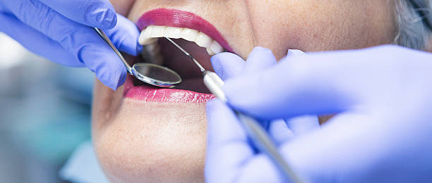 Best Broken or Cracked Tooth Emergency Dentist in Athens, TX